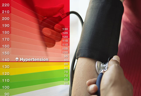 hypertension_symptoms.jpg